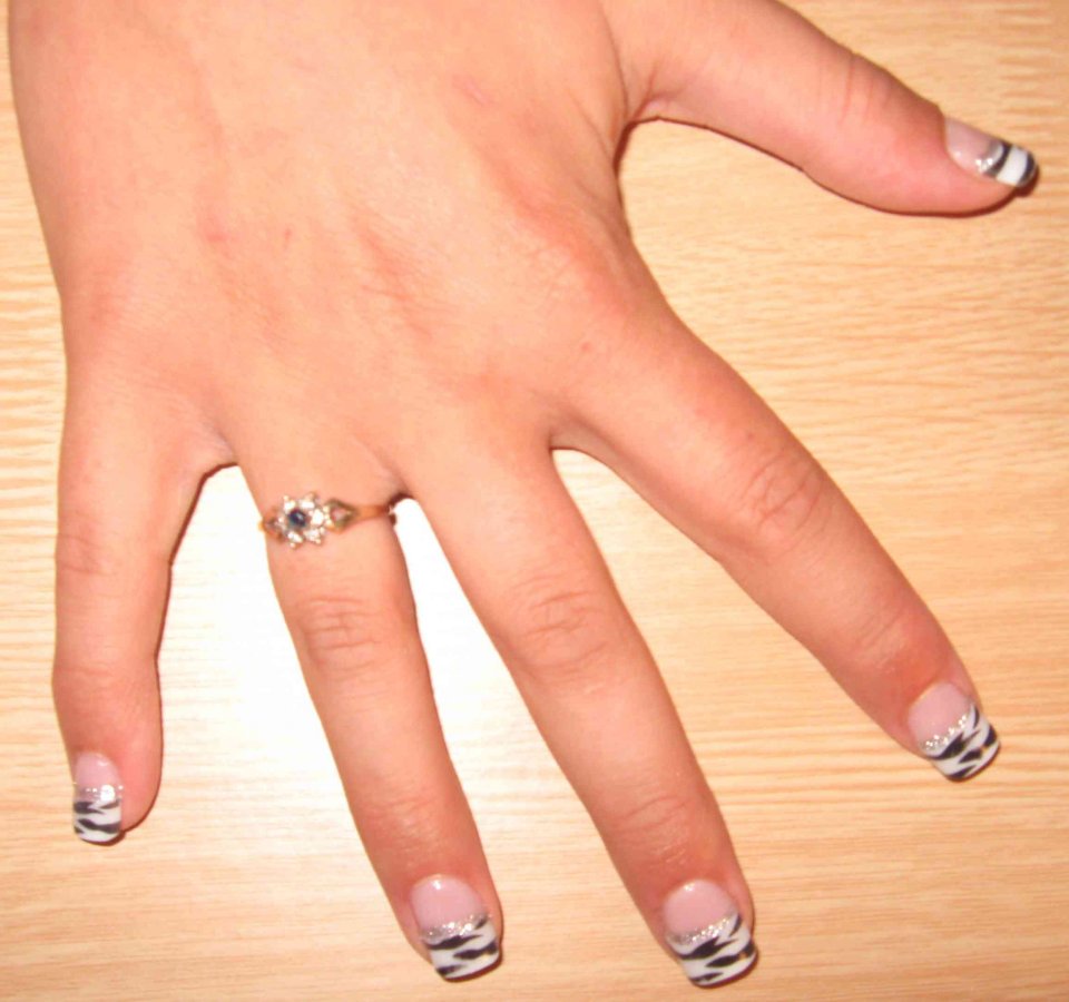Ongles zébrés